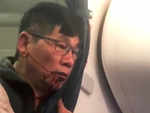 United Airlines: Passenger suffers broken nose, will file suit