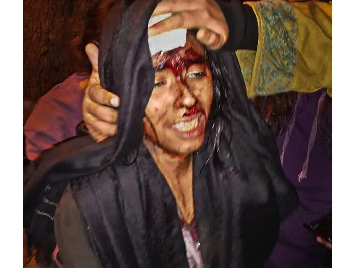 people admitted AIIMS trauma centre