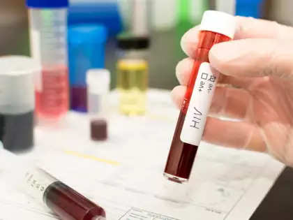 HIV breakthrough: Drug trial shows injection twice a year is 100% effective against infection 