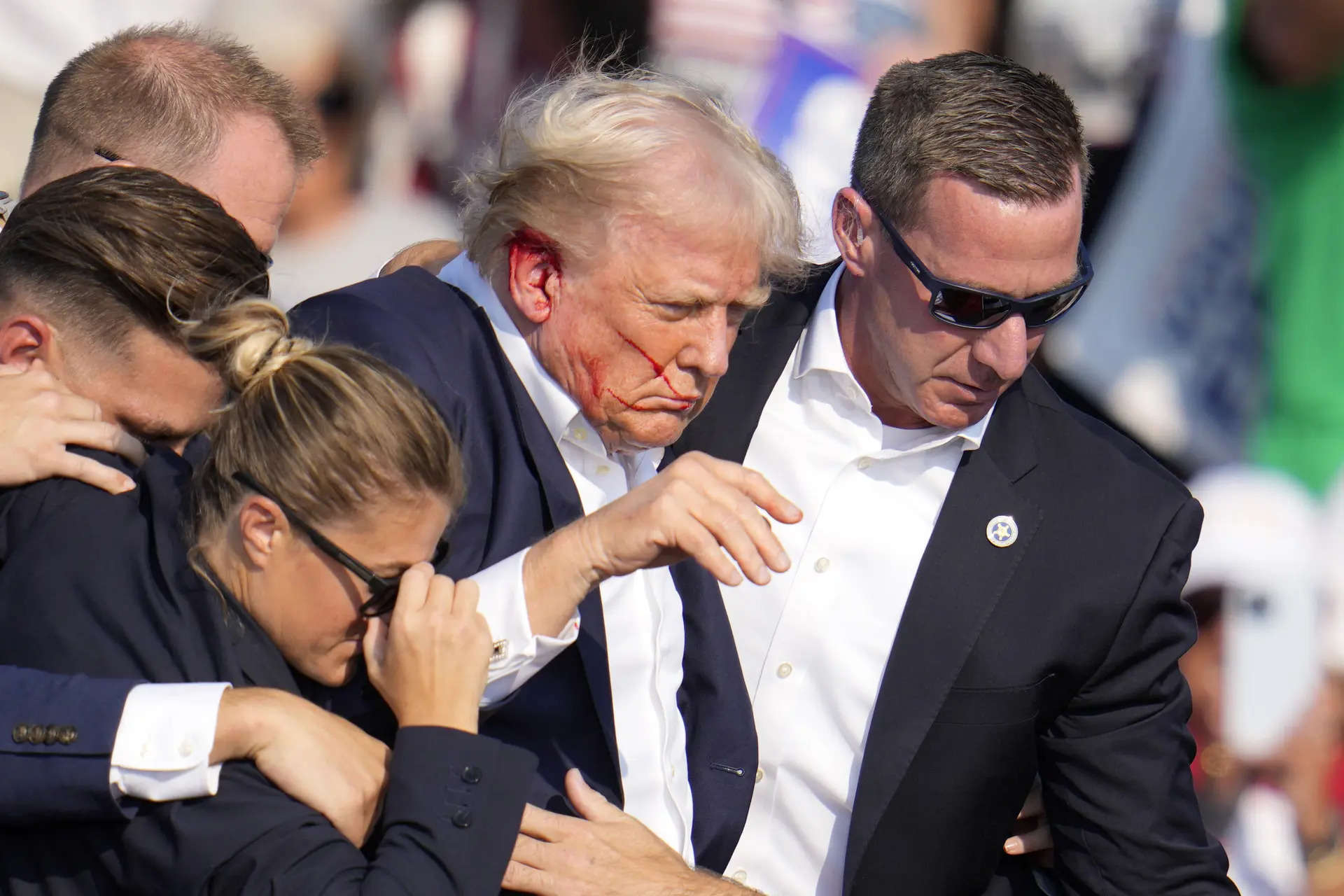 Trump's health and treatment after the assassination attempt? Here is what he underwent 