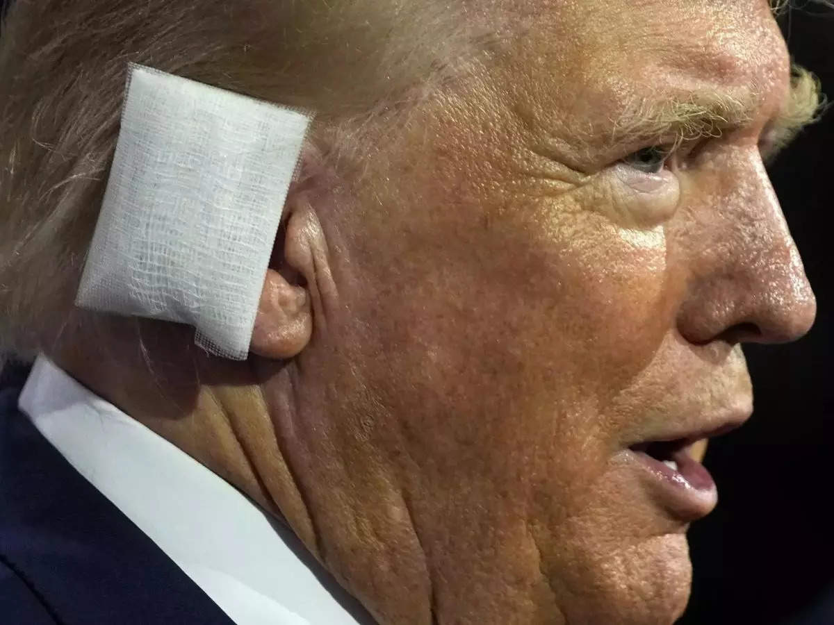 What is the ear reconstruction surgery that Donald Trump may have to undergo? 