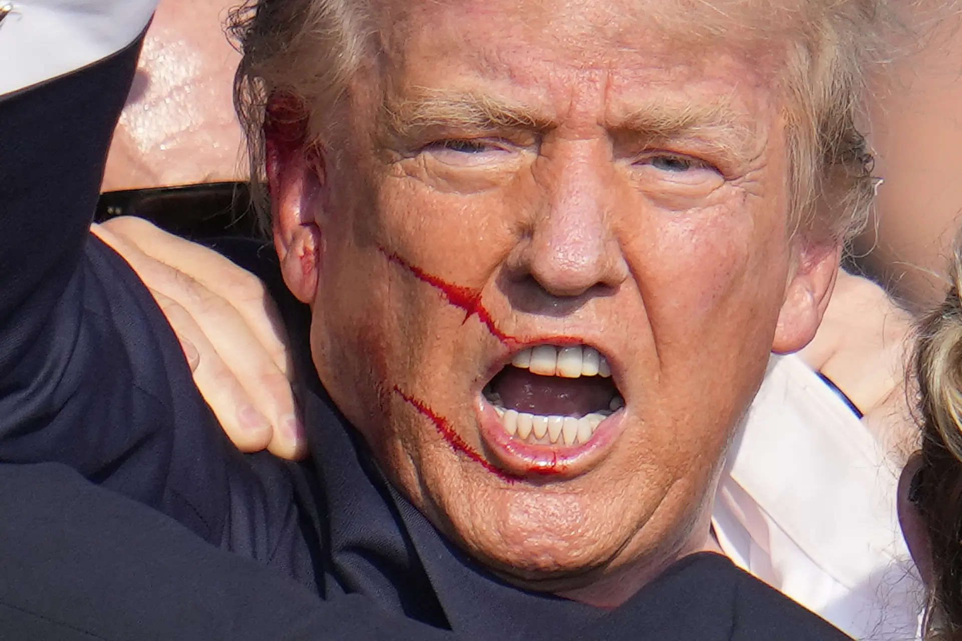 Donald Trump assassination attempt: Where are the stitches? Where are the scars?