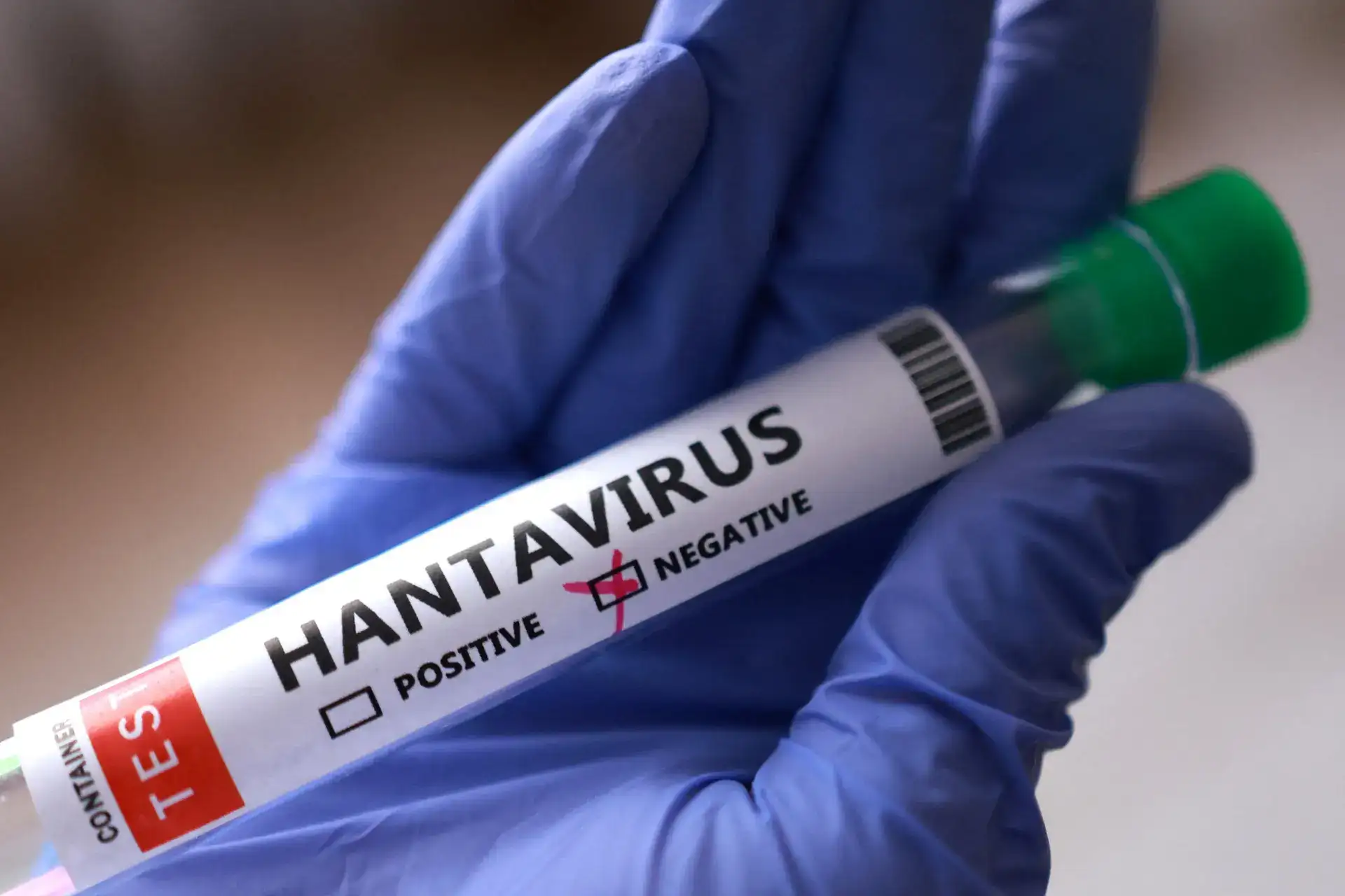 Hantavirus cruise ship outbreak: What is Andes strain? Symptoms, mortality rate, treatment, vaccines and all details you need to know