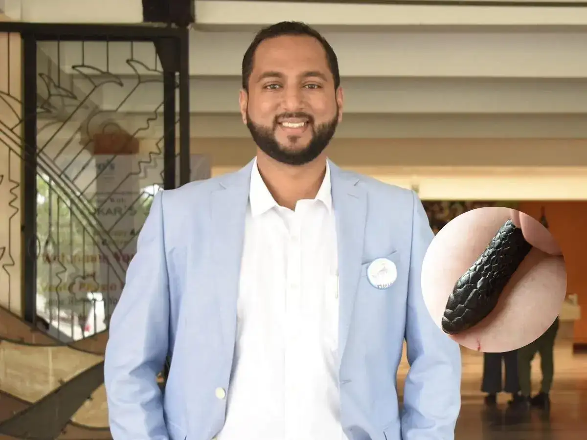 Ketan Bhatikar, Goa Congress leader, dies after snake bite
