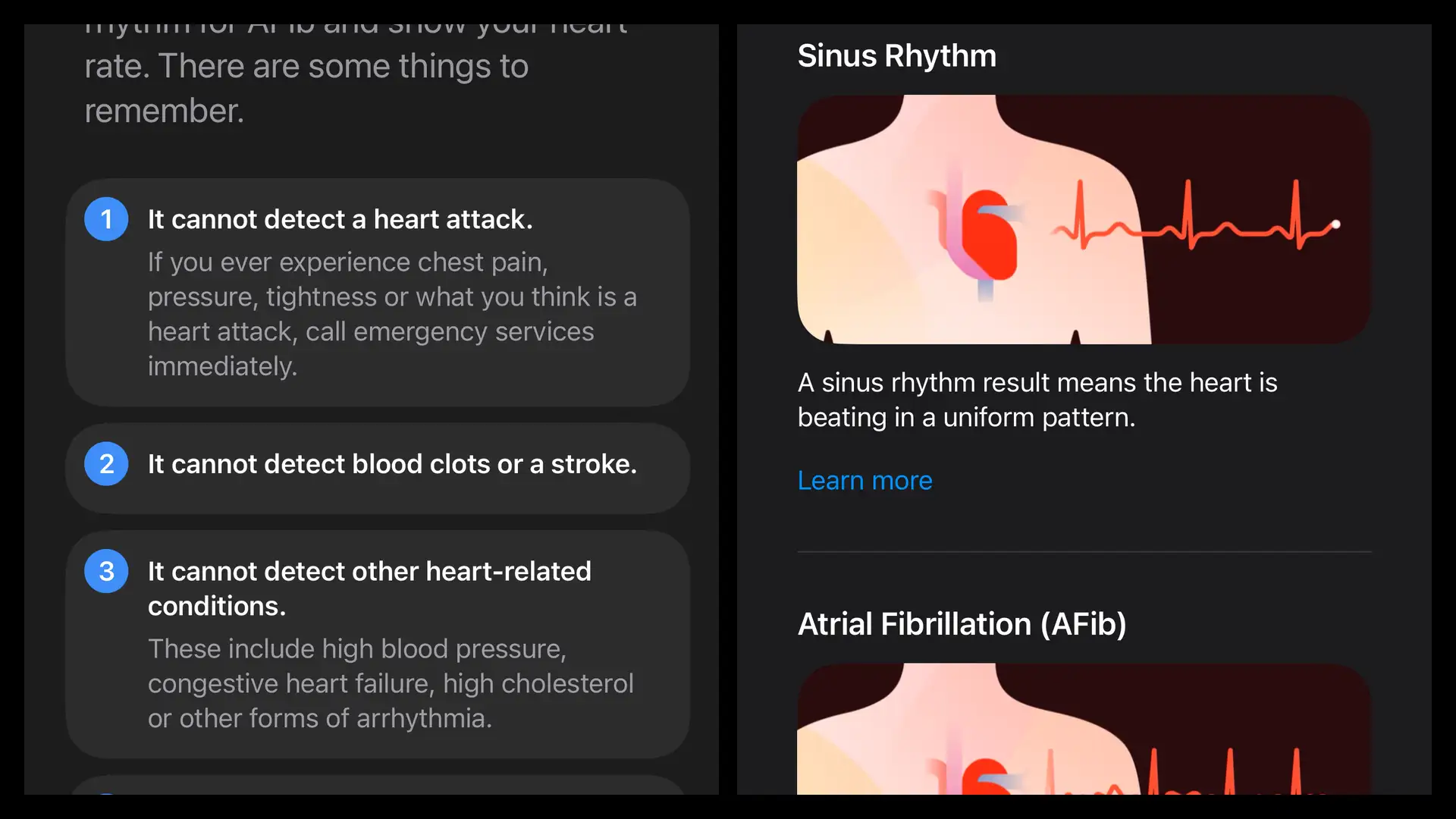 Apple Watch Ultra 4 Health and Fitness Apple Watch Ultra 4 Health and Fitness