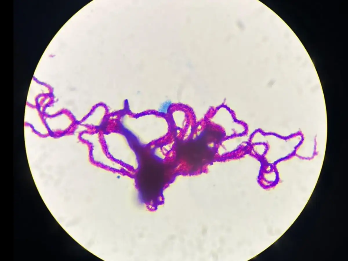 In 2018, over 6,000 volunteers examined pictures of tuberculosis bacteria exposed to drugs; their answers helped researchers test resistance to 13 medicines