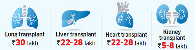 Health Insurance: Know the transplant expenses covered ...