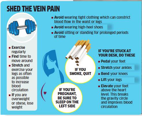 desk exercises for varicose veins
