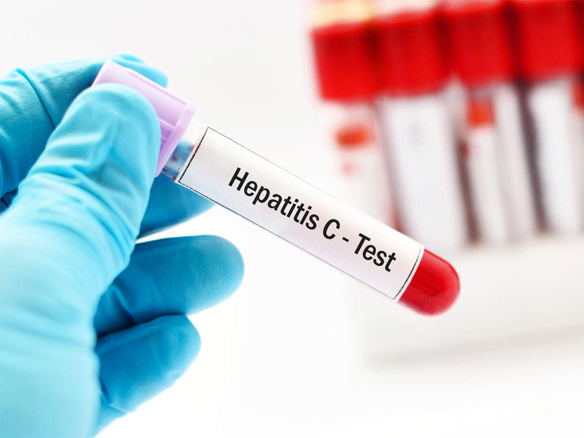 Global Hepatitis C Virus (HCV) Testing Industry