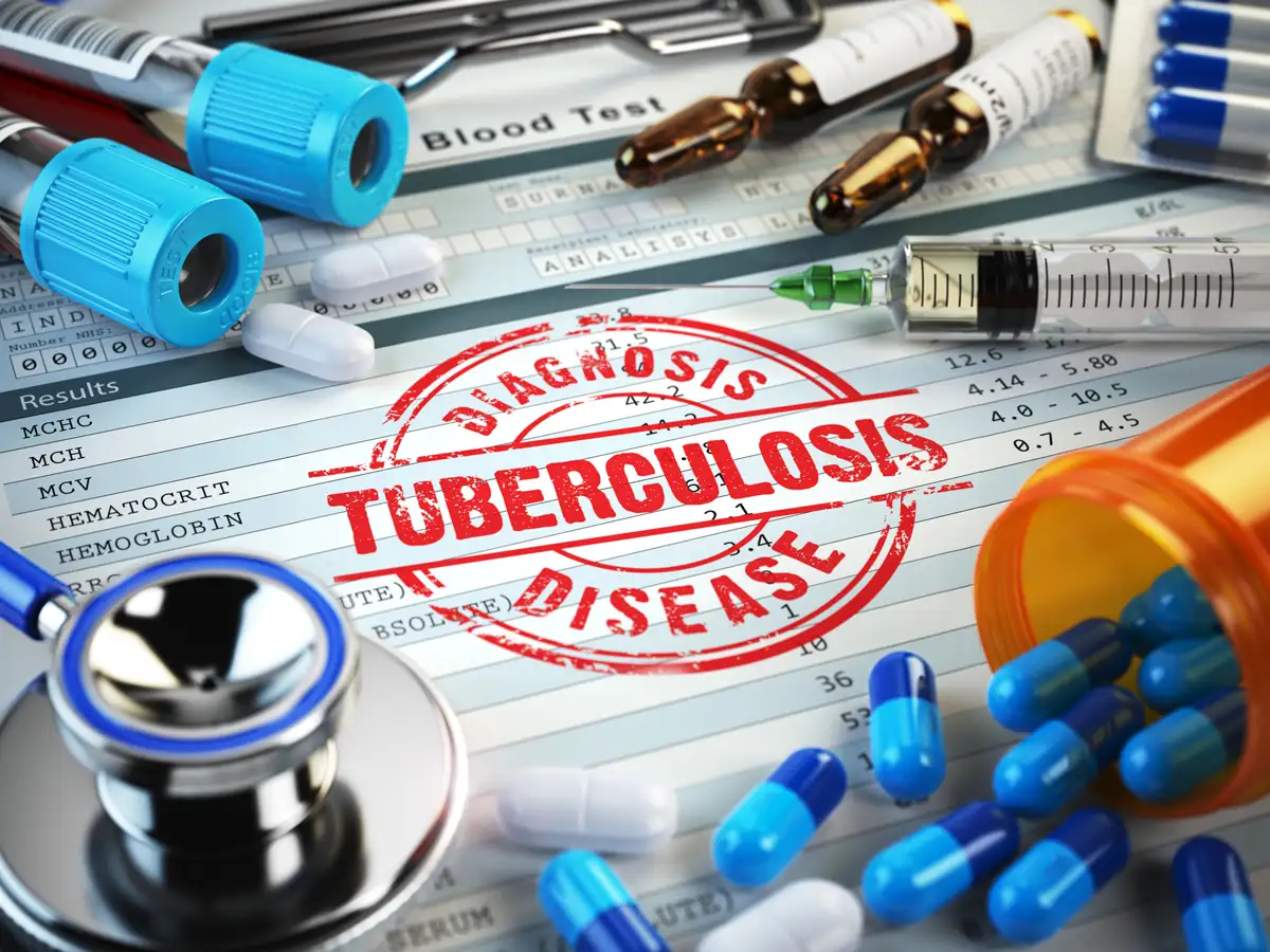 Tuberculosis World Tuberculosis Day Disease causes infertility, only
