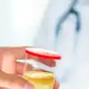 ​8 drinks to keep your uric acid levels balanced​