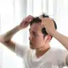 8 effective solutions for regrowing hair on bald spots