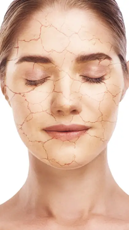 8 foods that secretly damage your skin