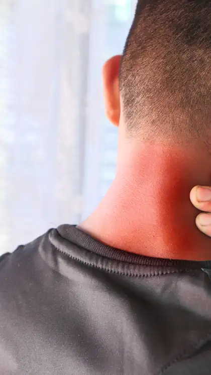 Dark patches on the neck