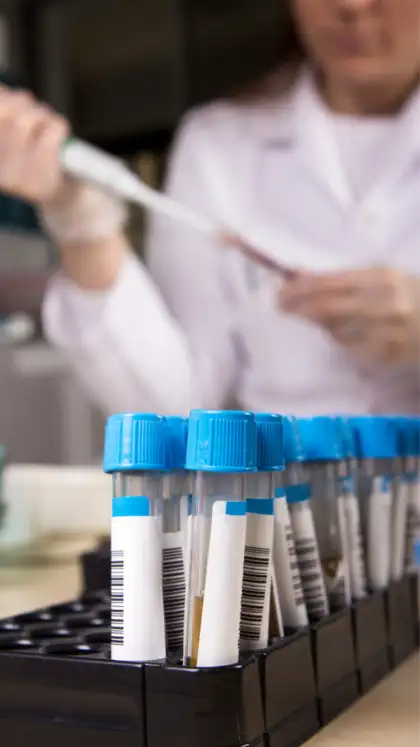 9 early symptoms of high uric acid in the body