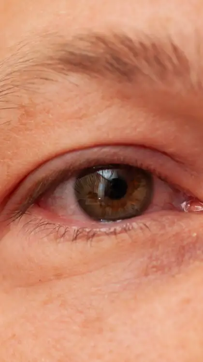 9 diabetes signs that show early in your eyes