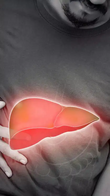 5 visible skin changes signaling liver failure