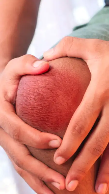 9 foods that can spike your uric acid levels