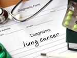 Swelling, fatigue, and other common ailments that could be signs of lung cancer