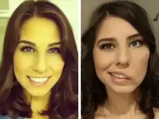 Beauty pageant contestant suffers massive stroke, undergoes 8 hour surgery to reconstruct face