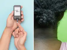 Hyderabad doctor rides Metro, makes a shocking diabetes discovery on many commuters’ necks