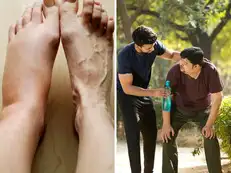 Swollen feet, breathlessness, failing kidneys: Patient thought walking and avoiding sweets had cured his ‘sugar’. His reports told another story