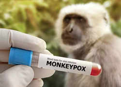 Monkeypox in India: Key do's and don'ts you need to follow