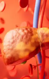 9 easy and natural ways to reverse fatty liver fast