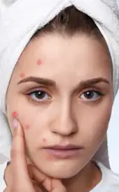 Your liver needs help: Spot these 9 symptoms on your face early