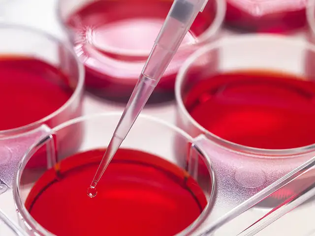Stem Cells Show Promise For Treating >> Stem Cell Implant Shows Promise For Parkinson S Treatment The Stem Cells Show Promise For Treating >> Stem Cell Implant Shows Promise For Parkinson S Treatment The