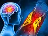 Blood vs brain cholesterol: What's good, what's risky, and why age matters