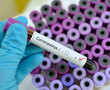 Coronavirus: The four stages of a global pandemic