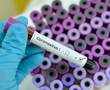 First wave of coronavirus not over even as countries begin relaxations