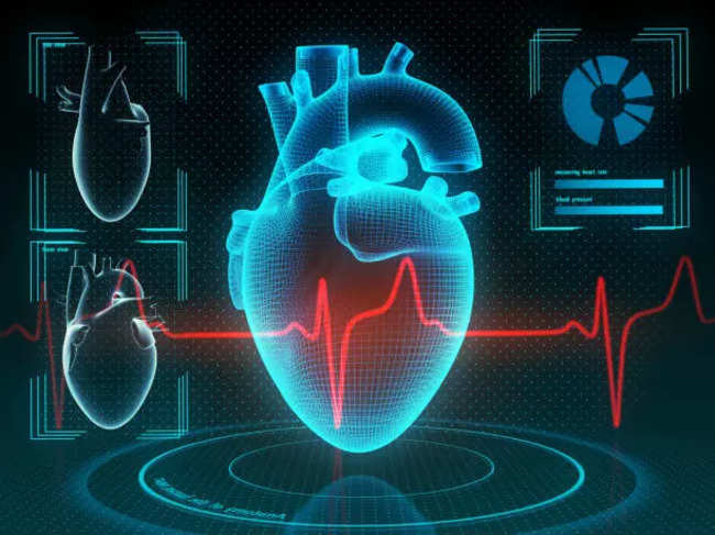 AI might improve heart attack diagnosis to reduce pressure on emergency departments: Research