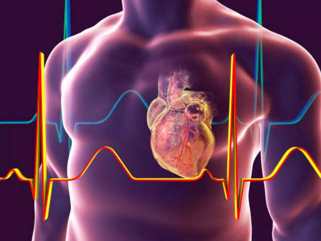 What is cardiac arrest?
