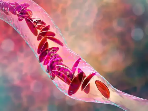 Symptoms of SCD