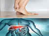 ​Watch Out! Cracked Heels, Itchy Feet Signal Liver Failure ​