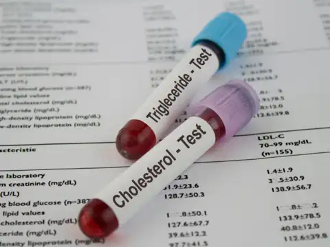 Triglycerides