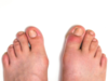 Here's how your feet can help detect diabetes
