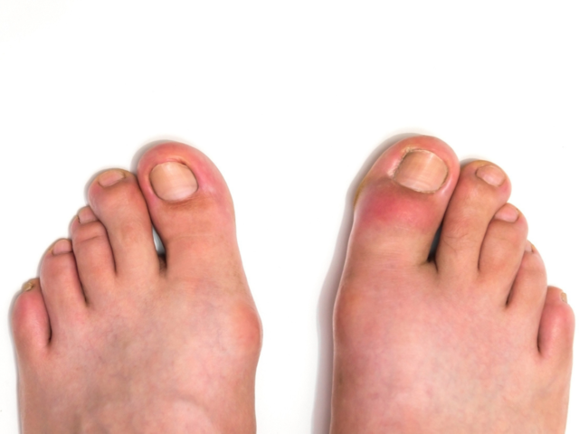 Did you know that your feet can provide clues about diabetes? 