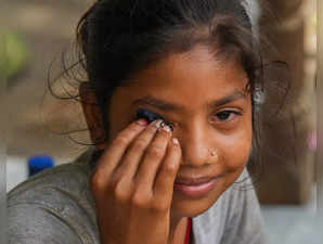 New Delhi: A child infected with eye flu at a makeshift camp for flood-affected ...