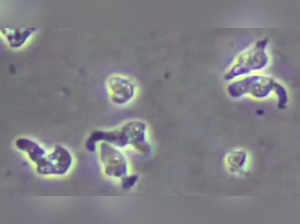 What is brain-eating amoeba, which killed Texas man after swimming in Lyndon B. Johnson Lake?