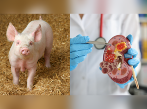 Pig kidney transplanted in human body continues to function, Scientists call it a breakthrough