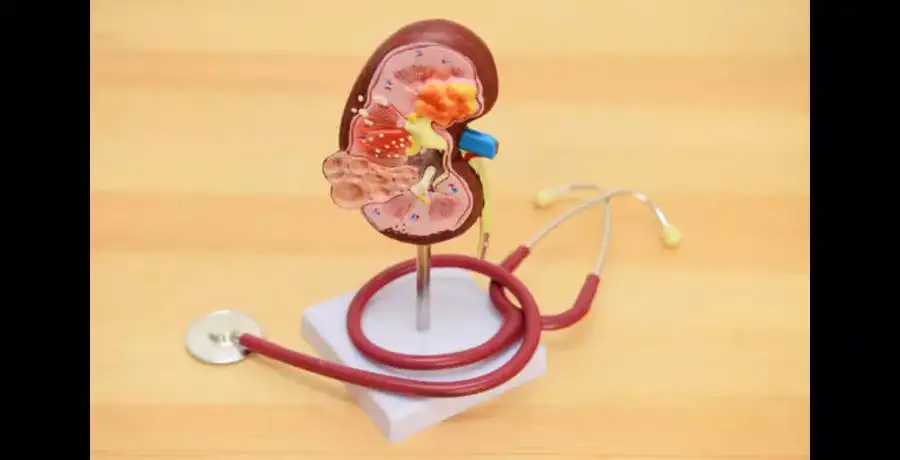 Tips for recovering after a kidney transplant | EconomicTimes