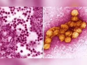 West Nile Virus has spread across US