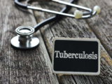 Danaher cuts TB diagnosis test cartridge by 20% for high-burden countries