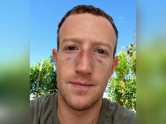 Mark Zuckerberg reveals brusied face in new Insta post. (Image Source: Instagram/ @zuck)