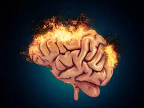 What Is Vascular Dementia?