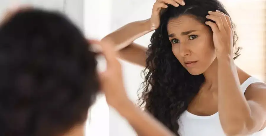 Home remedies to fight off dandruff efficiently - Vimarsana News