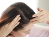 Ways to treat hair loss in winters